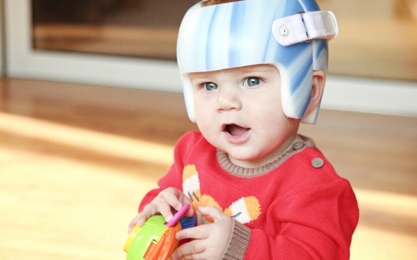 Flat Head Syndrome (Positional Plagiocephaly)