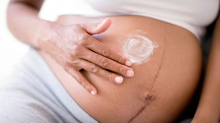 Skin Changes During Pregnancy